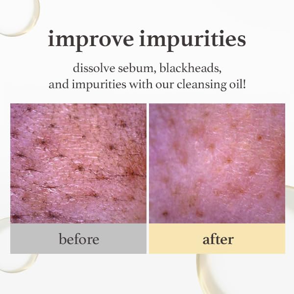 NOONI Facial Cleanser - Snow Aqua 0 LHA Toning Cleansing Oil | Makeup Blackhead Remover, Pore Control, Glass Skin, Help Control Sebum, Revitalizing, Mother's Day, 6.76 Fl Oz (200 ml)