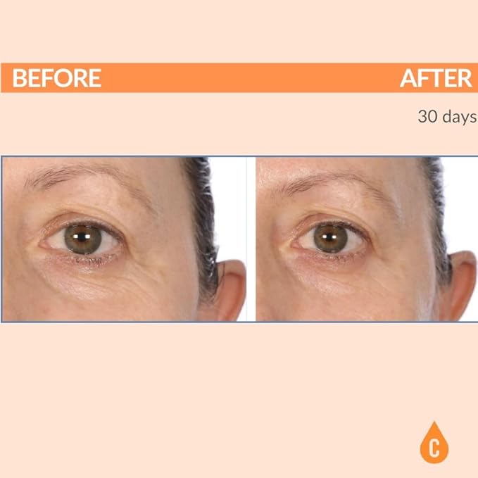 Serious Skincare - Vitamin C Eye Beauty Treatment Gel - Hyaluronic Acid & Collagen - For Undereye Lines, Wrinkles, Dark Circles - Hydrating & Soothing - C3 Plasma C Ester Biotechnology 0.5 oz.