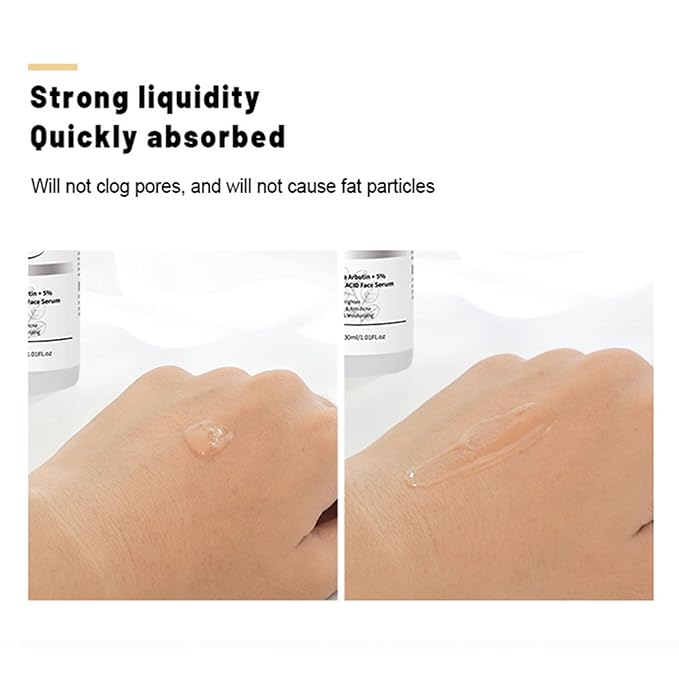 AICHUN BEAUTY Face Serum Eye Essence Anti-Wrinkles Anti-Acne Oil-Control Anti-Freckle Refreshing Moisturizing Purifying Shrink Pores 30ml 1.01FL.oz (10% Alpha Arbutin + 5% Mandelic ACID Face Serum)