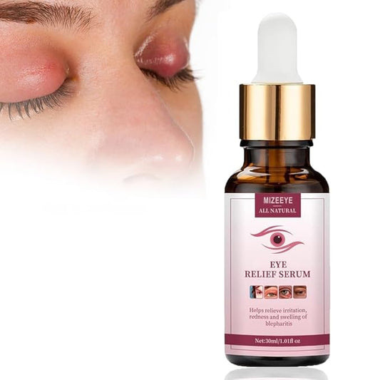 Chalazion Eye Treatment For Blepharitis, 30ml Moisturize Eyelids Serum and Chalazion Remover, Gentle Under Eye Relief Serum For Dark Circles, Eye Bags, Puffiness.