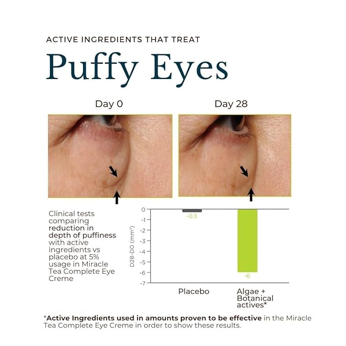 Juara Miracle Tea Complete Eye Creme | Nourish Dark Circles, Puffiness | Reduce Appearance of Fine Lines | Cruelty Free, Paraben & Sulfate Free, Vegetarian | 0.5 oz