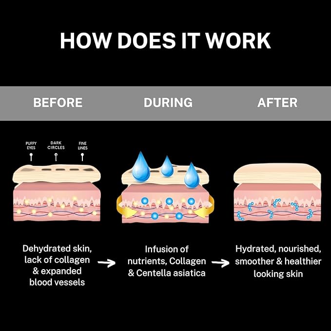 CÉLOR Under Eye Patches for Puffy Eyes and Dark Circles (32 Pairs) with Amino Acid & Collagen - Under Eye Masks Great for Bachelorette Party Favors, Swag Bag Stuffers, Spa Gifts for Women