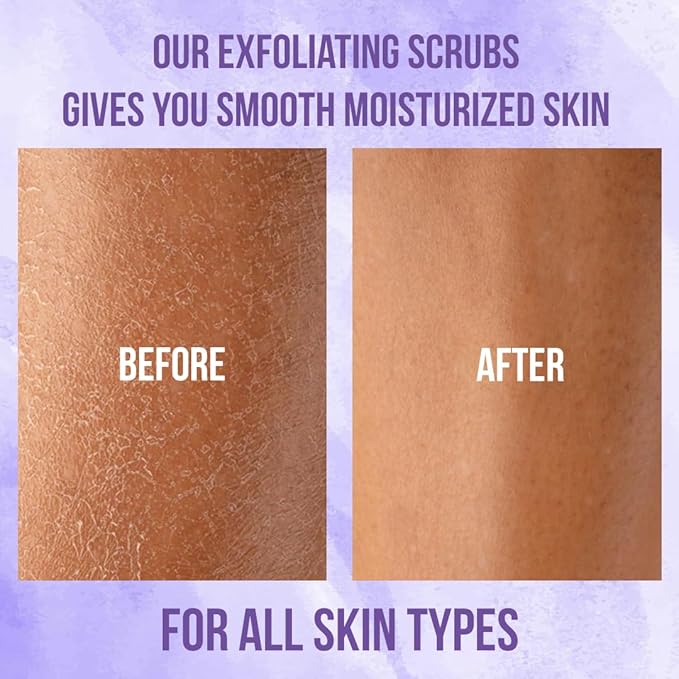 Lavender Oil Body Scrub, Organic Exfoliator for Soft Skin, Pure Exfoliate, Deep Cleanse, Natural Women Exfoliating Dead Sea Salt Face Scrub, Moisturizing Skin, Acne, Cellulite, Scars, LARGE 12oz Jar