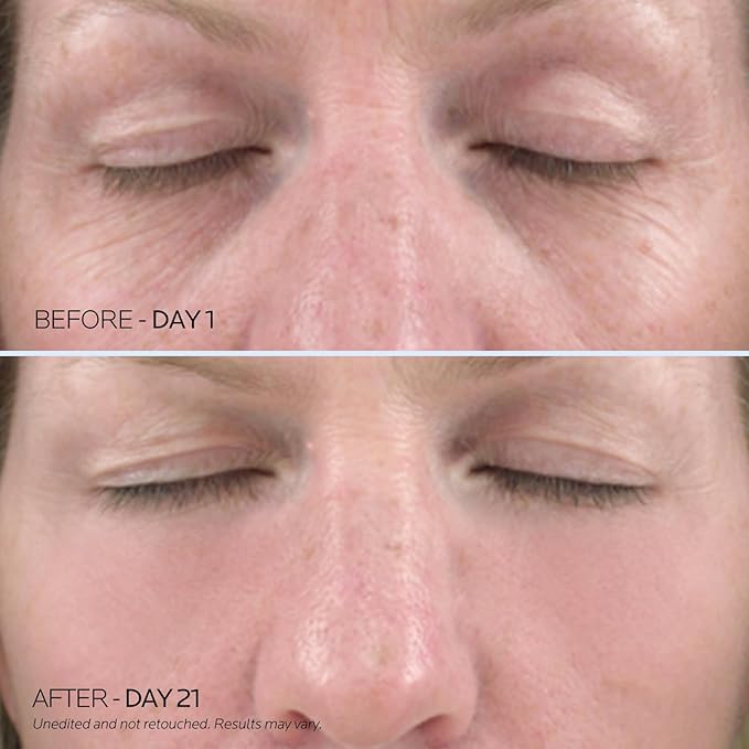 Dr. Pure Under Eye Patches for Wrinkles: Retinol Collagen Eye Mask for Puffy Eyes and Dark Circles with Hyaluronic Acid - Smooth Fine Lines Moisturizing and Hydrating (30 Pairs)