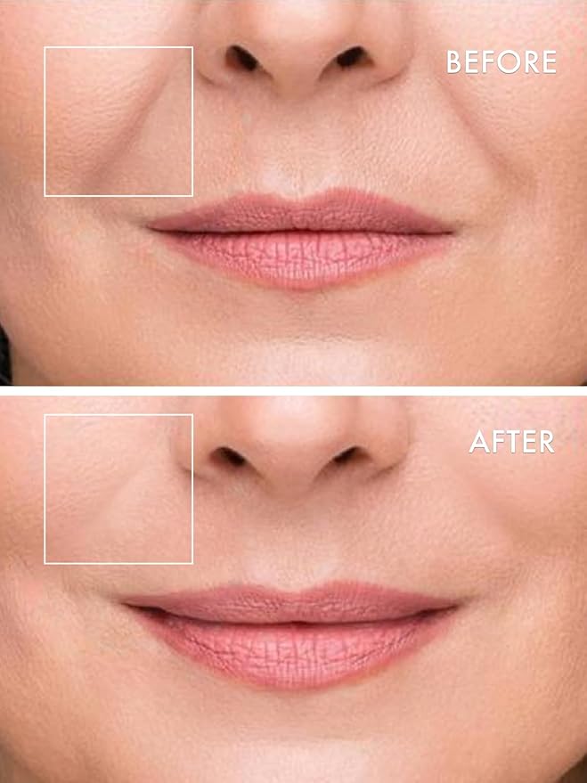 depology Deepcare+ Serum-Infused Micro Dart Patche | 4 Pairs Eye Mask | Under Eye Patches for Wrinkles | Fine Lines | Hydrating Eye Mask with Peptides | Amino Acids | and Synthesized Molecules