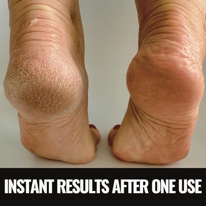 SandBar Heel Revival Regimen Mother's Day Gift - Home Pedicure Kit, Foot Spa Kit Pedicure Set, Foot Care Products for Soft, Smooth, Callus-Free Feet - Hawt Dawn