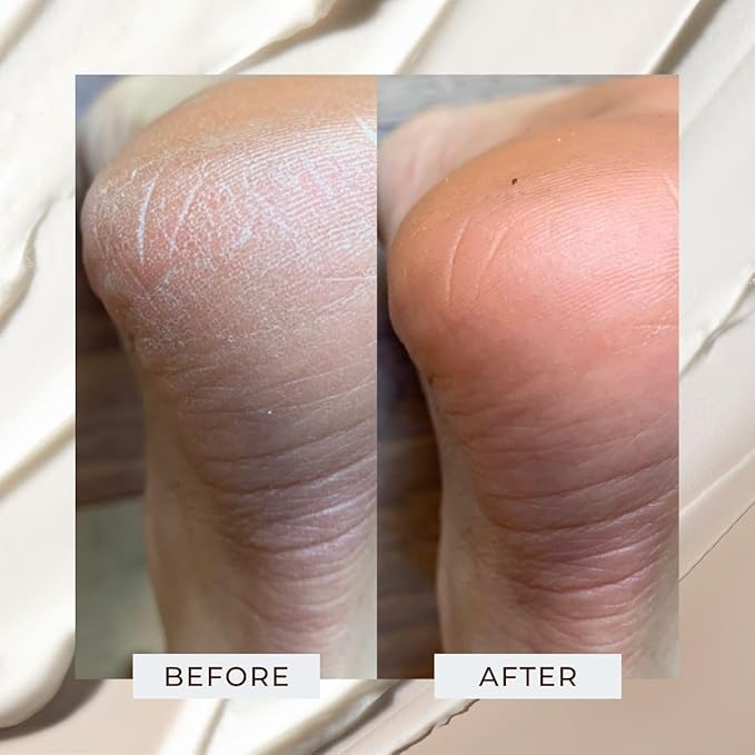 Juara - Candlenut Body Creme | Moisturizing Lotion | Dry Skin Hydration | Skin, Hands & Feet Cream | Soothing Skincare Balm | Cruelty Free, Paraben, Sulfate Free, Vegetarian | 7.5 oz