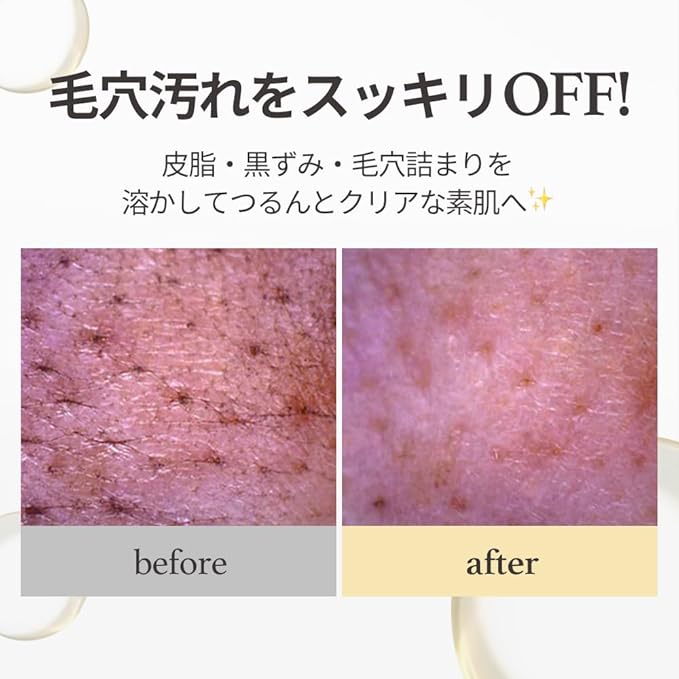 NOONI Facial Cleanser - Snow Aqua 0 LHA Toning Cleansing Oil *2ea | Makeup Blackhead Remover, Pore Control, Glass Skin, Help Control Sebum, Revitalizing, Moisturizing, Korean Skin Care, 6.76 Fl Oz x 2