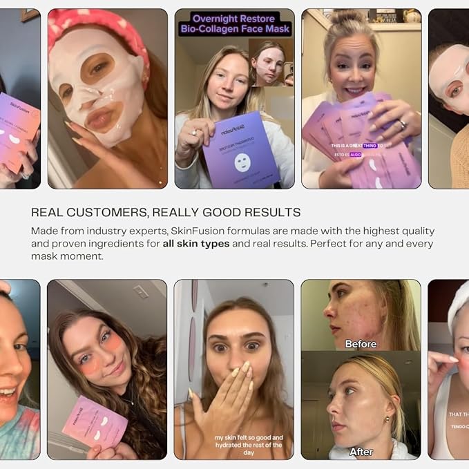 Collagen Under Eye Mask Patches (Anti-Aging + Firming 20 Pairs) with Niacinamide + Peptides - Anti-Aging, Fine Lines, Wrinkles, Dark Circles, Puffy Eyes, Under Eye Bags - Mother's Day Gifts