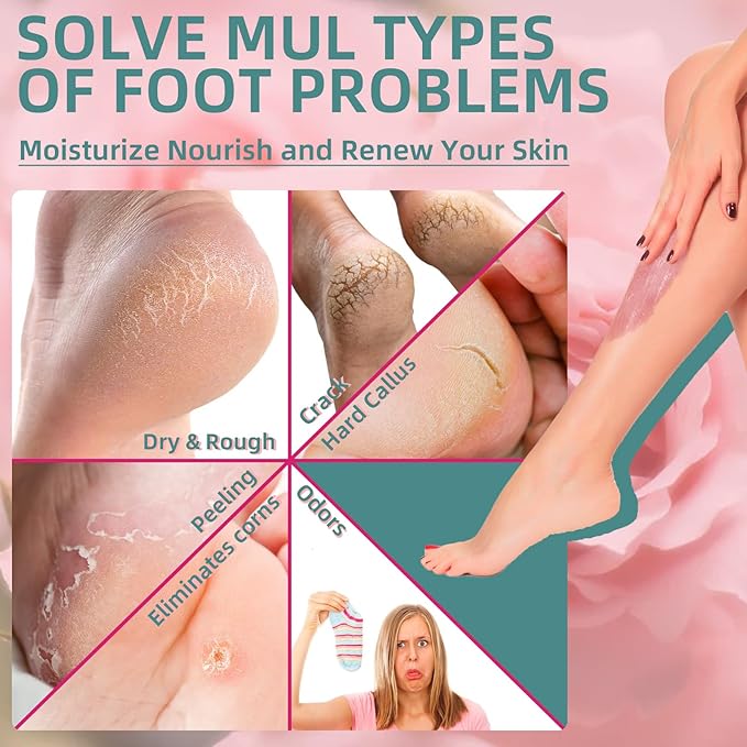 Foot Exfoliating Scrub, Sugar Scrub, Dead Skin Remover for Feet, Individually Packaged Foot Scrub Smooths, Hydrates, Detoxifies Tired and Dry Cracked Feet 16 Packs per Box, Rose