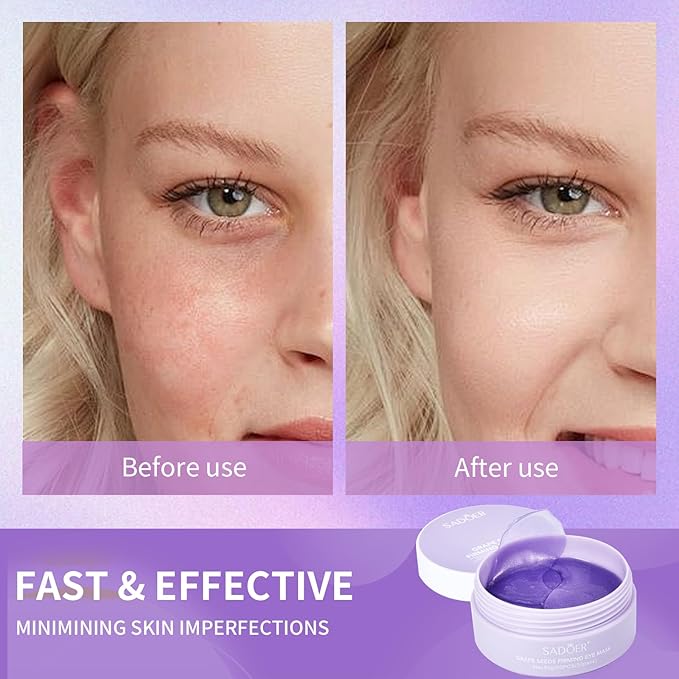 Under Eye Patches,Natural Hydrating Eye Patches with Grape Extracts to Relieve Puffy Eyes & Dark Circles (60 Pcs), Rich in Collagen for Anti-wrinkle, Fine Line Reduction & Moisturization