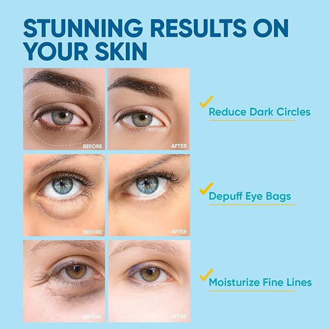 Under Eye Patches for Women: 30 Pairs of Hydrating Collagen Gel Eye Masks with Retinol & Hyaluronic Acid - Smooths Fine Lines & wrinkles/Delays Aging/Reduces Dark Circles & Eye Bags & Puffy Eyes