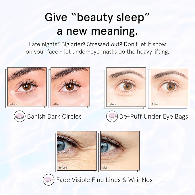 grace & stella Under Eye Patches for Puffy Eyes and Dark Circles (Retinol, 48 Pairs) Restoring Gel Under Eye Masks with Hyaluronic Acid - Vegan Cruelty-Free Skincare Birthday Gifts for Women
