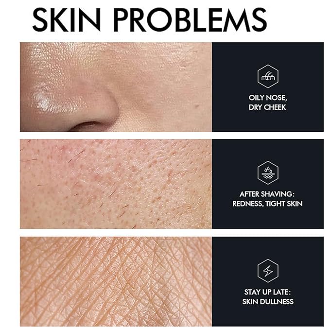 Cool Oil Control Mens Facial Care Kit, Mens Skin Care Kit With Face Wash, Moisturizer, Toner, Lotion, Face Mask, For Hydrating, Deep Cleansing, Men Skin Care Kit Gift Set For Birthday