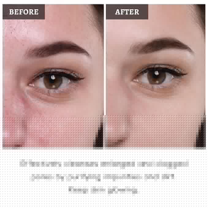 Face Mask Set, 4Pcs Clay Mask, Face Masks Skin Care with Vitamin C, Charcoal, Mugwort and Purple Clay, Skincare Gift Set for Blackheads, Refining Pores & Controling Oil, Dry Oily Skin