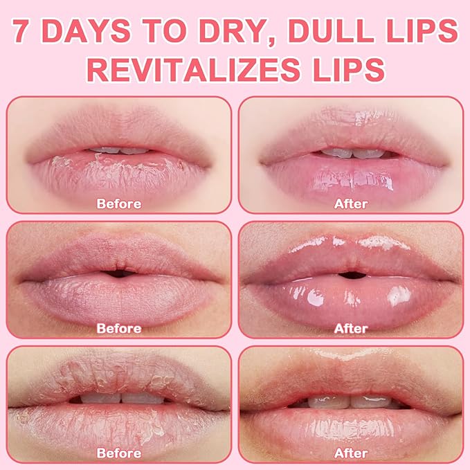 4 PCS Bee Lip Balm Honey Pot, Lip Scrub & Lip Mask Set Honey Watermelon Apple Strawberry Honey Lip Balm Sleeping Lip Mask Overnight with Sticks, Lip Exfoliating Prevention Dry and Crack