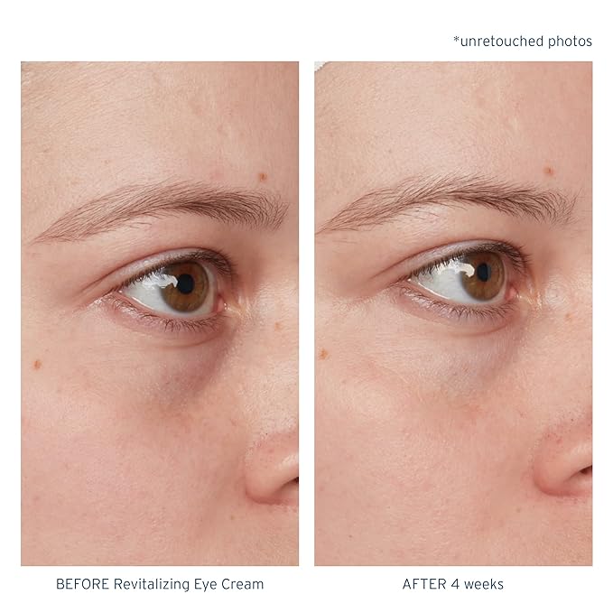 Santo Remedio, Piel Eterna, Revitalizing Eye Cream, Illuminating Eye Cream, Helps Reduce Dark Circles, Contains Marina Algae, Caffeine, Aloe, Hyaluronic Acid, Vitamin E, For All Skin Types, 1 Fl. Oz.