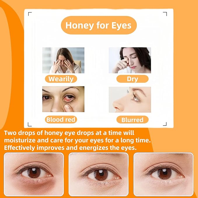 Ximonth Jimerito Honey for Eyes - Jimerito Honey Eye Drops - Botanical Extracts and Honey, Moisturizes, Relieves Dryness and Nourishes Eyes, Eye Care Drops 1 oz (2PC)