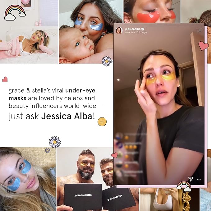 grace & stella Award Winning Under Eye Mask - Birthday Gifts For Women - Bridesmaid Gifts - Reduce Dark Circles, Puffy Eyes, Undereye Bags, Wrinkles - Under Eye Patches - Vegan (24 Pairs, Pink)