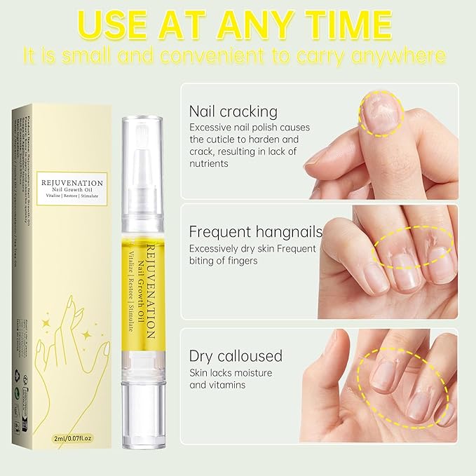 Nail Nutrition Oil Pen Nail Treatment Cuticle Revitalizer Oil Nail Growth Oil for Repairing and Strengthening Peeling and Broken Fine Nails