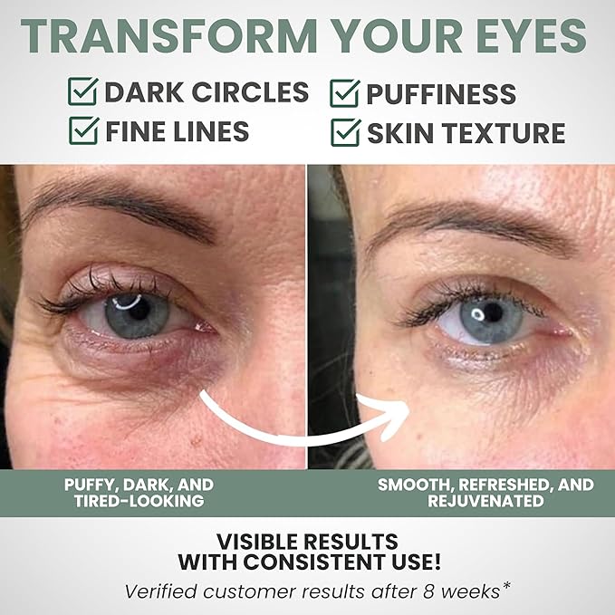 Under Eye Gel Cream – Reduces Dark Circles & Puffiness, Repairs & Moisturizes, Hydrating and Refreshing Formula for Under Eyes Skin, 1.7 oz