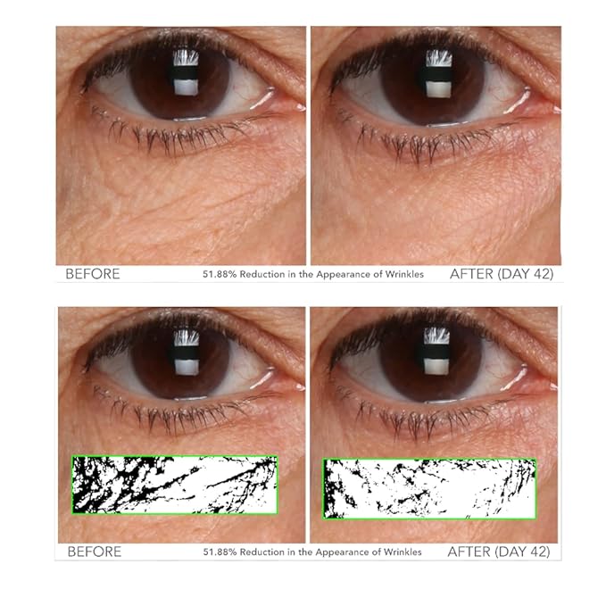 Serious Skincare - Vitamin C Eye Beauty Treatment Gel - Hyaluronic Acid & Collagen - For Undereye Lines, Wrinkles, Dark Circles - Hydrating & Soothing - C3 Plasma C Ester Biotechnology 0.5 oz.