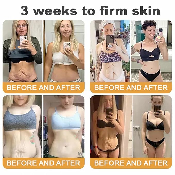 Bee Venom Firming Serum - 30g, Anti-Aging Face Serum, Lifting & Tightening Serum, Reduces Wrinkles & Fine Lines, Hydrates & Nourishes Skin, for Women & Men