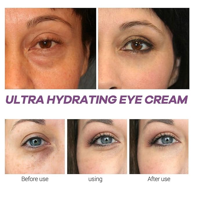 Xylane Eye Cream for Dark Circle & Puffiness, Caffeine/Pro-Xilane Active Anti-Wrinkle Eye Cream, Anti-Aging Active Eye Repair/Lifting Cream for Anti-Oxidation, Fade Fine Lines around Eyes-15 G