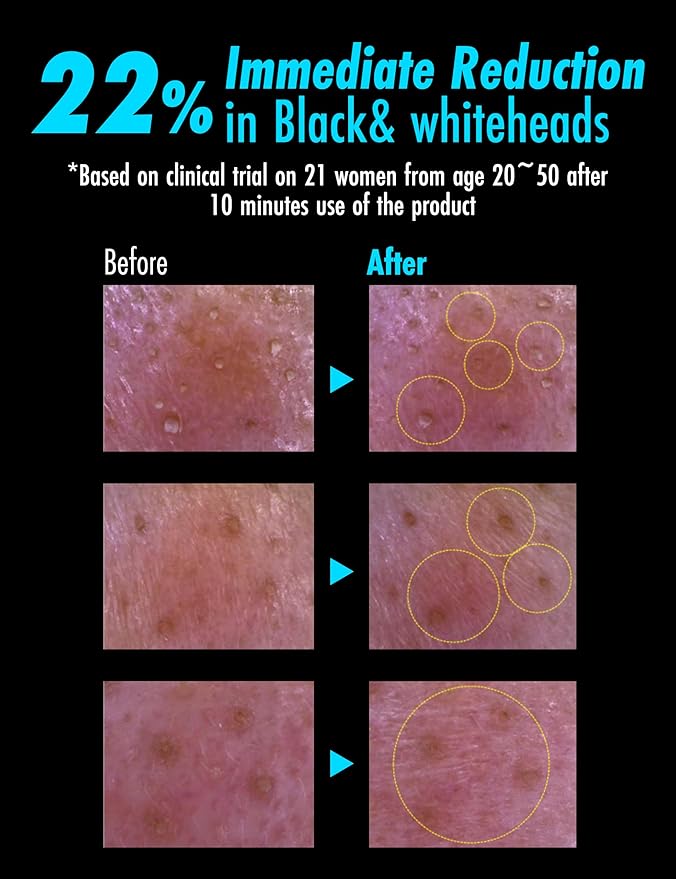 Meditime Pore Care Clay Masks (Corset Pack)