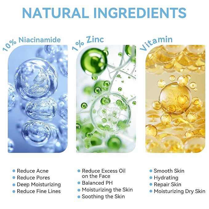 10% Niacinamide + 1% Zinc Face Serum, Nourishing & Refreshing Facial Serum , Women Serum for Oil Control and Acne 30ML/1 Fl Oz