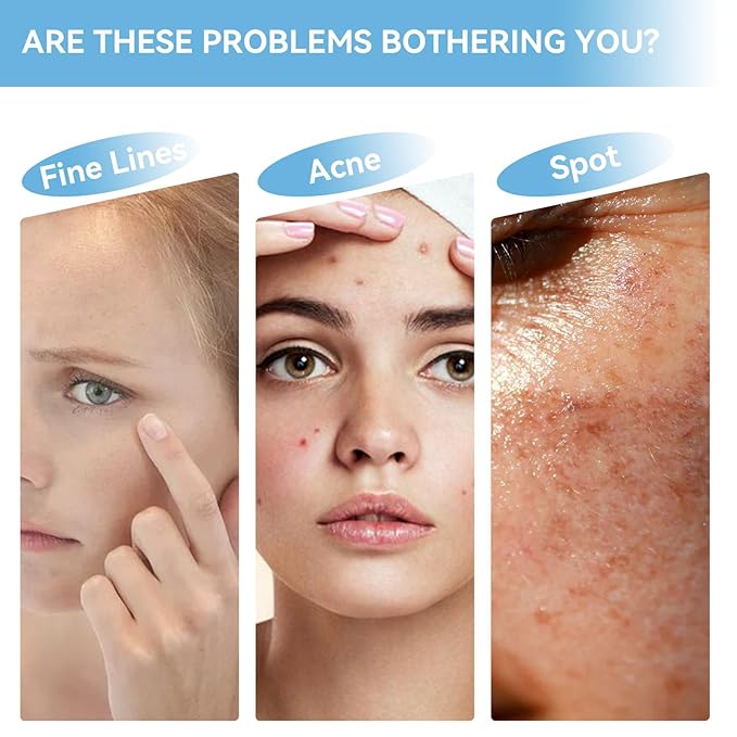 10% Niacinamide + 1% Zinc Face Serum, Nourishing & Refreshing Facial Serum , Women Serum for Oil Control and Acne 30ML/1 Fl Oz