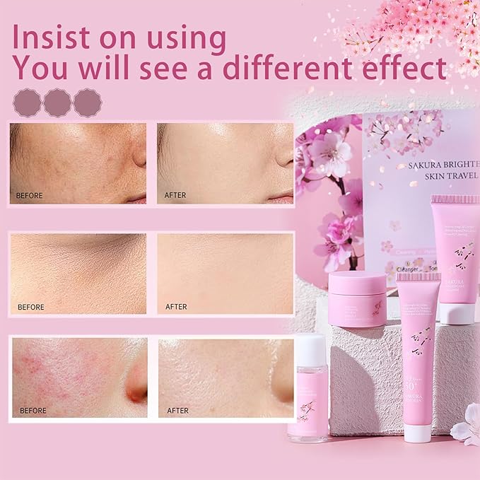 Sakura Skincare Gifts for Teenage Girls Skincare Kits - Skin Care Sets & Kits - Cherry Blossom Skin Care Kit - Pamper Sets For Women Gifts - Travel Size Face Wash-Toner-Moisturizer-Sunscreen