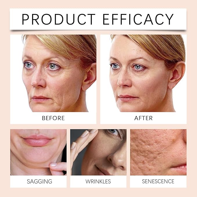 Bee Venom Firming Serum - 30g, Anti-Aging Face Serum, Lifting & Tightening Serum, Reduces Wrinkles & Fine Lines, Hydrates & Nourishes Skin, for Women & Men