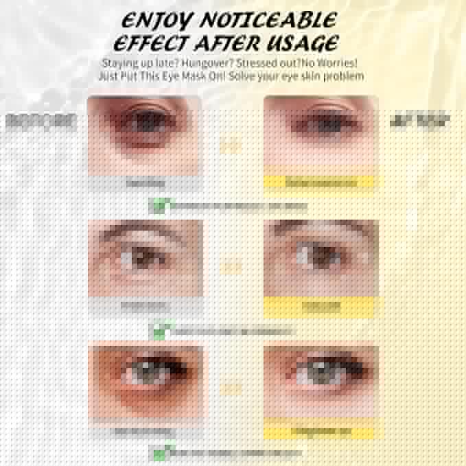 Under Eye Patches(25 Pairs), 24K Gold, Caffeine, Hyaluronic Acid, Aloe Vera Eye Masks for Dark Circles Puffy Eyes Undereye Bags, Eye Skin Care Gift Set for Bachelorette Party Favors