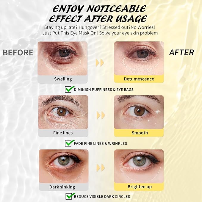 Under Eye Patches (25 Pairs), Hyaluronic Acid Eye Masks for Dark Circles Puffy Eyes Undereye Bags, Collagen Eye Patches for Wrinkles and Hydrate, Skin Care Gift for Her