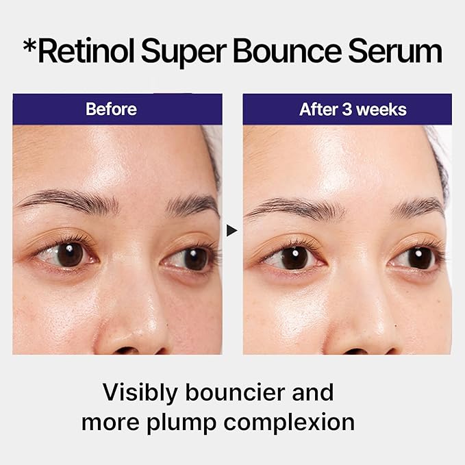 IOPE Retinol Super Bounce Serum | Korean Retinoid Eye Treatment for Anti-Aging, Beginner Friendly, Reduction in Fine Lines & Wrinkles, Firming and Rejuvenating, Daily Glow Routine, 1.69 Fl Oz. (50ml)
