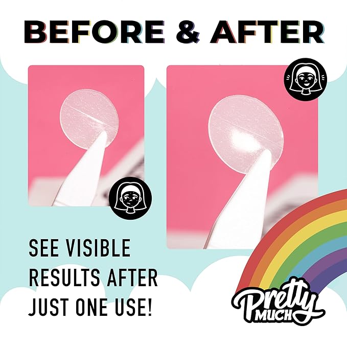 Pretty Much Pretty Patch Pack (1 Pack/72 Count) Pimple Patch, Acne Sticker, Acne Patch, Healing Blemish Dot, Anti-Pimple Popper Sticker, Natural and Gentle for All Skin Types, Day/Night Use