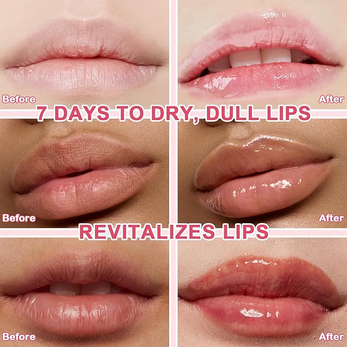 4 PCS Bee Lip Balm Lip Mask Honey Pot Lip Mask & Lip Scrub Set, Watermelon & Cherry & Coconut & Apple Lime Lip Mask Propolis Moisturizing Lip, Hydrating Prevention Dry and Cracked