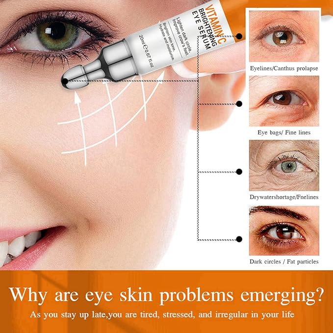 Vitamin C Eye Cream For Dark Circles, Under Eye Bag Cream Anti Aging Firming Creams For Women, Hydrating Eye Moisturizer Cream Reduce Fine Lines