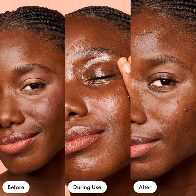 HERO COSMETICS Dissolve Away Daily Cleansing Balm - Helps Remove Makeup and Grime - Wonât Clog Pores - Suitable for Sensitive and Acne-Prone Skin (2.2 fl oz)