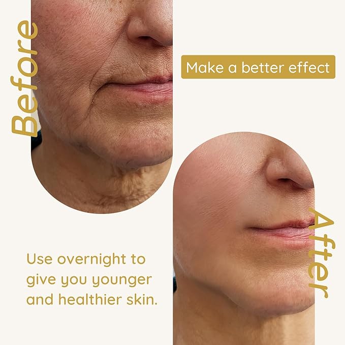 Enaskin Naturals Anti Wrinkle Face Patches Anti Wrinkle Gel Face Masks