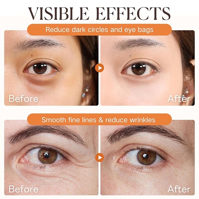 2PCS Retinol Eye Stick - Retinol Eye Cream Anti Aging - Under Eye Cream for Da rk Circles - Serum for Puffiness and Bags under Ey es - Skin moisturizer for Women Hydrates,Firms,Smooth(2pcs)