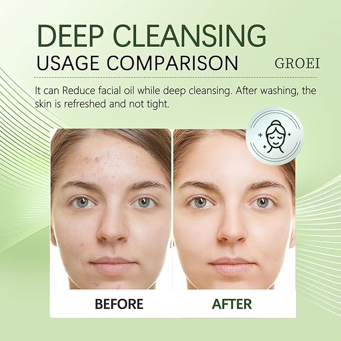 Face Wash, Oil Face Wash Oil for Face Skin Irritation And Prevents Breakouts – Deeply Cleansing, Hydrating for Calm Fresh Skin (1)