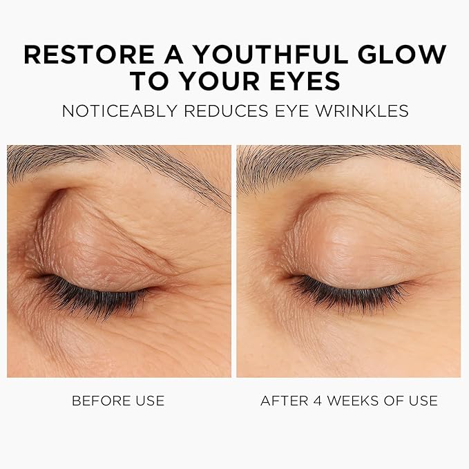 MOMOHOO Retinol Caffeine Under Eye Cream – Anti-Aging Eye Cream with Soluble Collagen for Puffiness, Wrinkles, and Under-Eye Bags, Hydrating & Soothing Formula for Women (0.68 fl. oz)