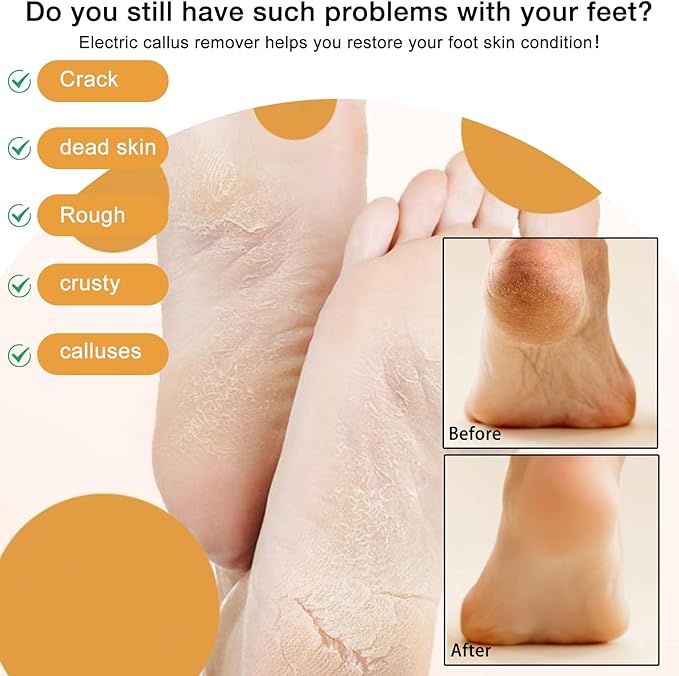 Electric Foot Callus Remover, 2024 New USB Rechargeable Foot Repair and Grinding Device, Heel Polisher Digital Display, Electric Foot Exfoliating Scrubber with 3 Grinding Heads 2 Speeds (Grey)