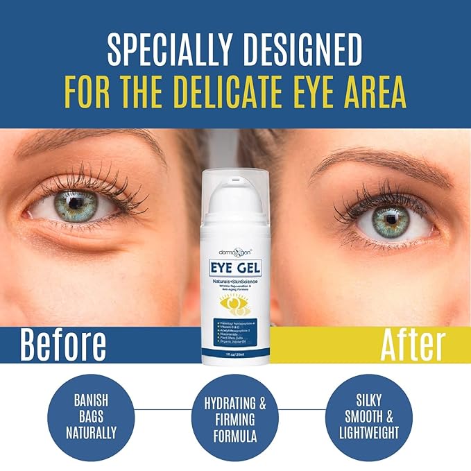 Eye Gel with Plant Stem Cells & Peptide Complex for Under & Around Eyes – Reduces Puffiness, Dark Circles & Fine Lines – With Matrixyl 3000 & Arginine for a Smoother, Refreshed Look for Men & Women.