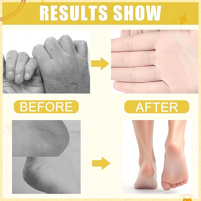 2Pcs Turmeric Foot Cream Set, Hydrating & Softening Hand and Foot Cream Balm Stick, Hand and Foot Cracked Heel Moisturizer, for All, Heel Balm Stick for Dry Elbows, 1.41 Oz Each