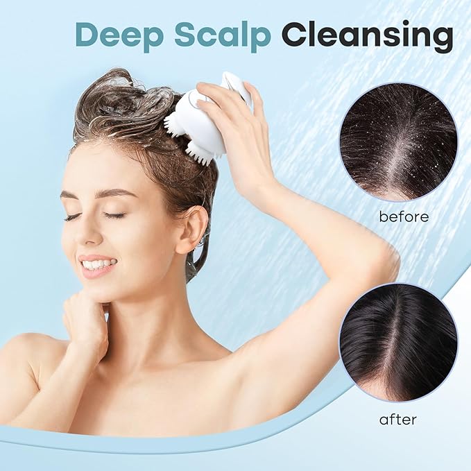 arboleaf Scalp Massager Electric Gripping Head Massager Scalp Stress Relax Portable Rechargeable Hair Massage Waterproof Cat Massage Tool, Gift for Mom