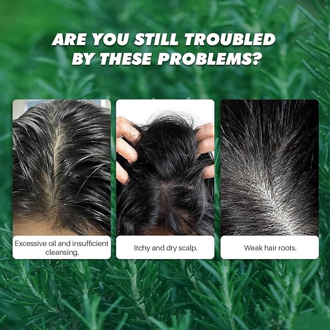 Scalp Scrub, Rosemary Mint Scalp Exfoliator Scrub with a Silicone Scalp Massager, Clarify and Remove Build Up, Deep Cleansing, Scalp Soothing, Reduce Oily Hair, Promotes Hair Growth