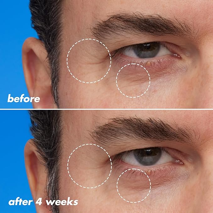 e.l.f. SKIN Youth Boosting Blue-ty Sleep Night Oil, Gentle Overnight Face Oil, Treats Fine Lines & Uneven Texture, Lightweight, Vegan & Cruelty-Free